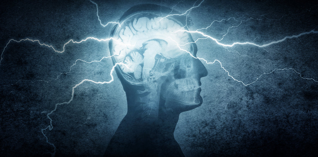 Do Migraines Change The Brain?